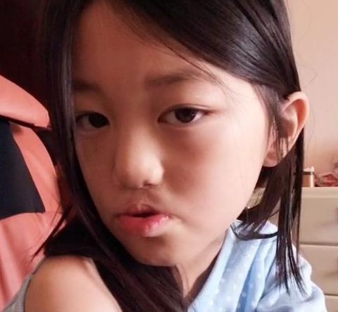 王菲的女儿李嫣3次整容,成功修复兔唇,网友:美得超越了