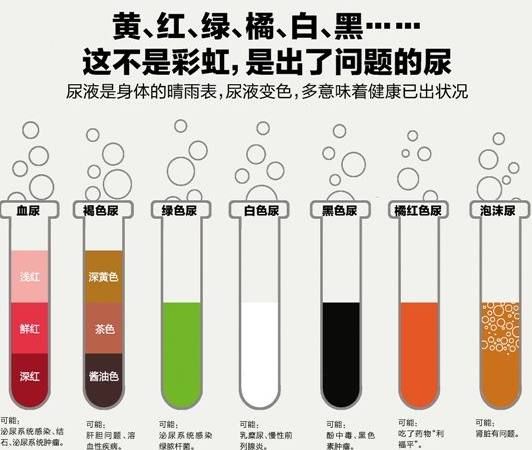 健康的尿液应当是淡黄透亮的,就像你沏的第一遍茶水.