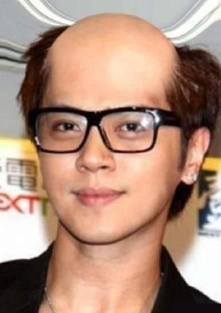 当明星们遇到地中海发型,感觉还是胡歌最帅啊!