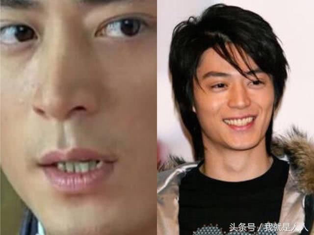 男星矫牙前,吴亦凡又村又土,胡歌简直换张脸,看到杜海涛我吐了