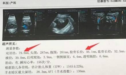 符合这10条特征的99%生男孩,孕妈一目了然,快快准备迎接男宝!