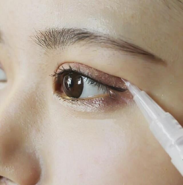 原来双眼皮还可以这样弄,不开刀不打针,自然又显眼睛大