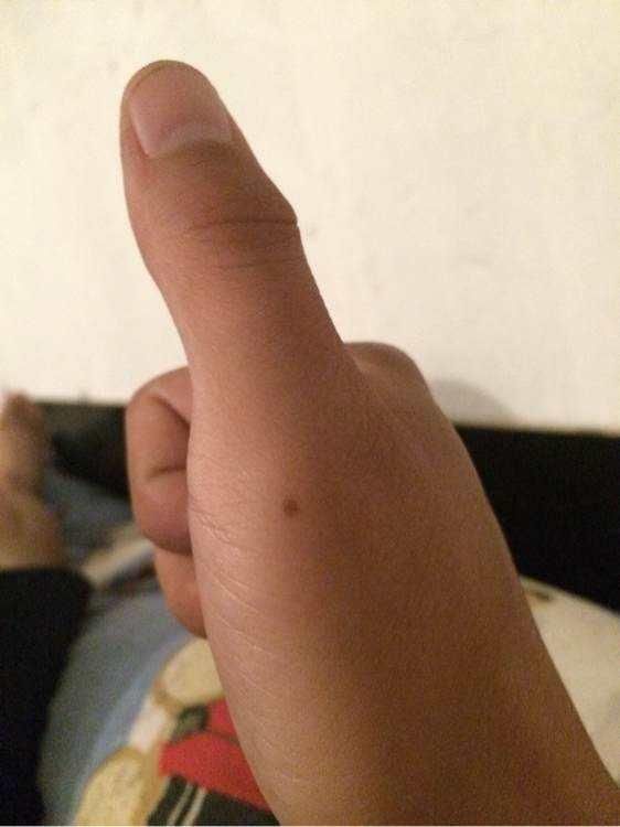 手指有痣要看痣的位置,大拇指附近有痣的人代表命中贵人是自己的父母