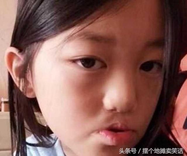 李嫣近况遭曝光,兔唇消失直接美成小公举,如今比她妈都漂亮!