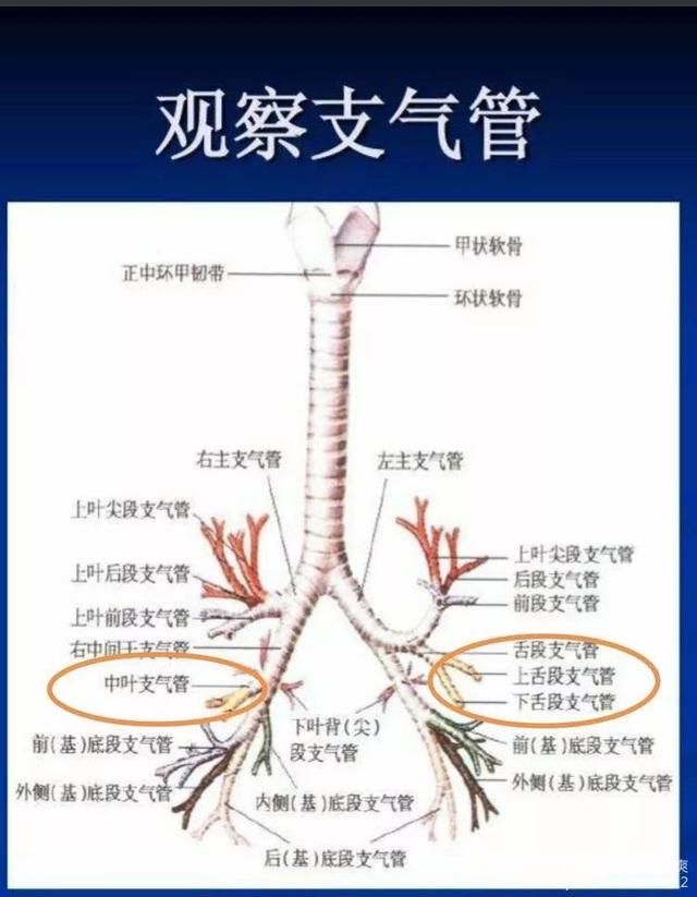 右肺10个肺段,左肺也细分为10个肺段