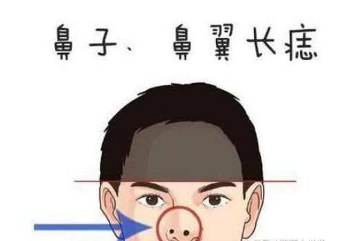 鼻子上有痣的人,注定是一辈子劳碌的命,鼻头长痣,则象征着多灾多难