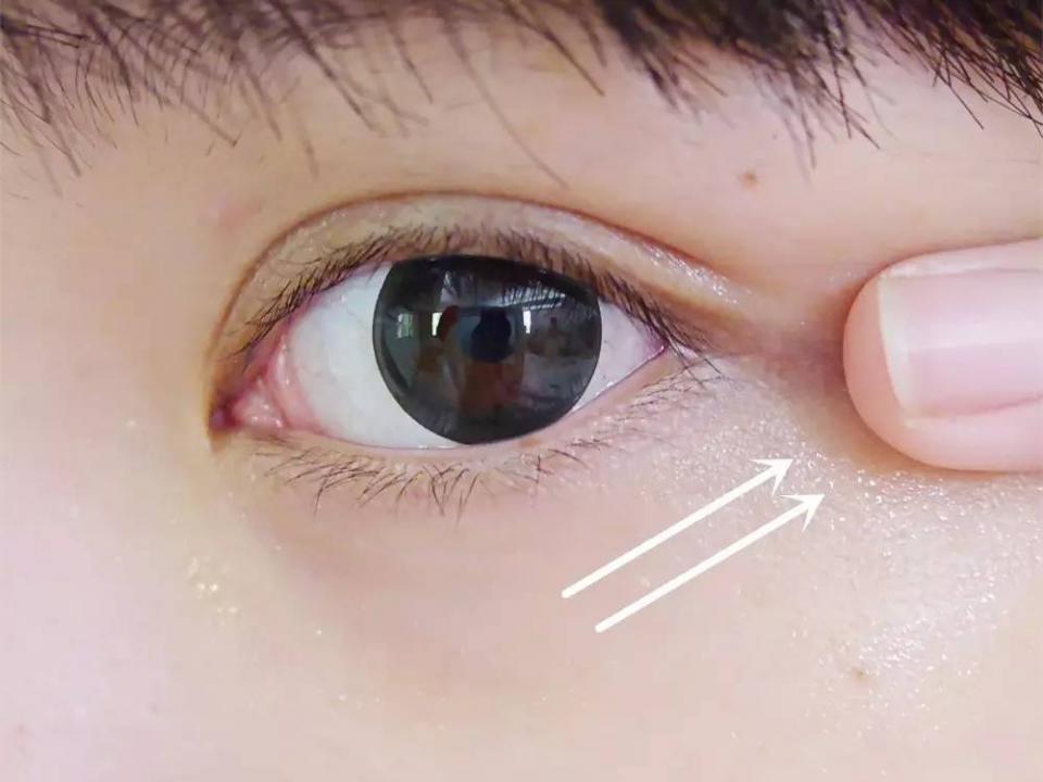 一不留神,眼睛"亮"红灯!