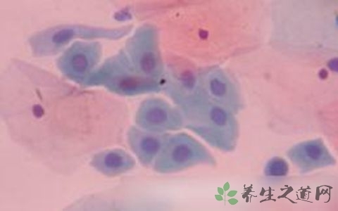 怎样彻底治愈隐性梅毒