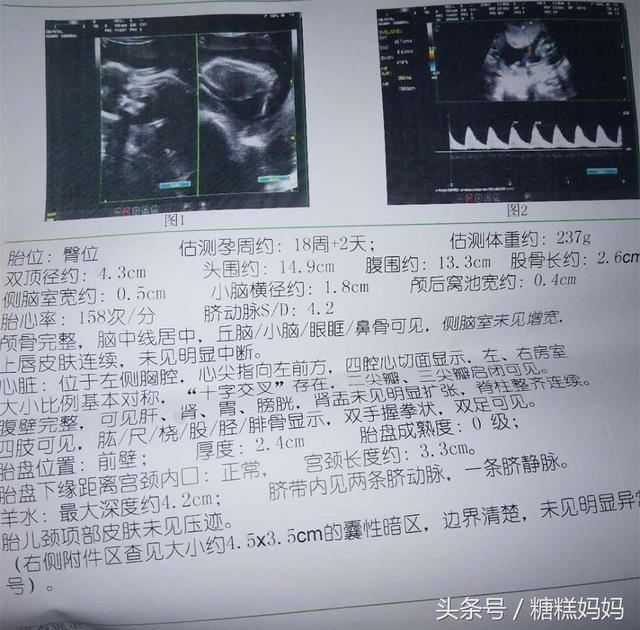 一般孕期到22-29周之后就要进行排畸四维检查了.
