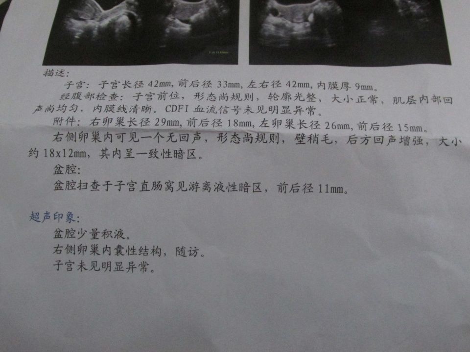 囊肿,回声欠均,上皮内病变……教您解读常见妇科体检