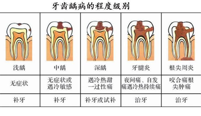 牙齿里面发黑跟什么因素有关?