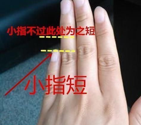 如下图,这位缘主的小拇指比较短,在无名指的第一节之下,故叫小指短