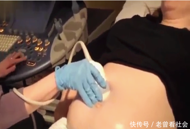 妻子怀孕,肚子大到只能躺床上,剖腹产8胞胎,性别让医生傻了眼