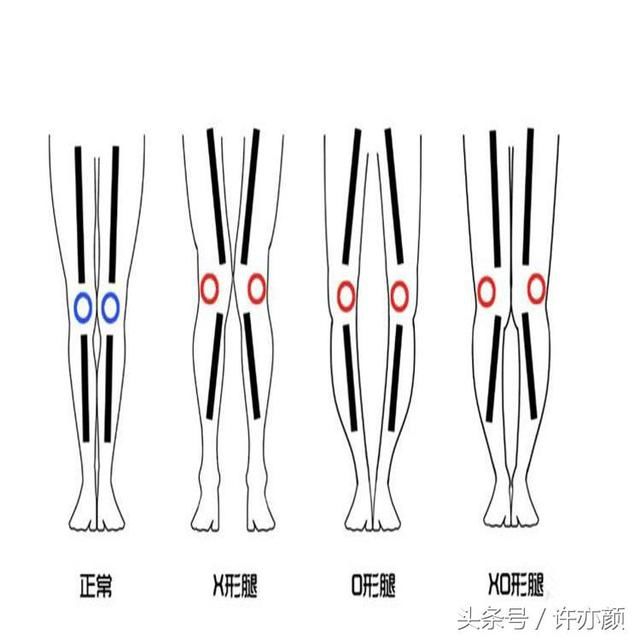 理想蓖腿