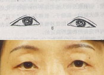 女人假如三角眼,或者吊眼,并且兼有三白眼与四白眼的,这是心性恶毒的