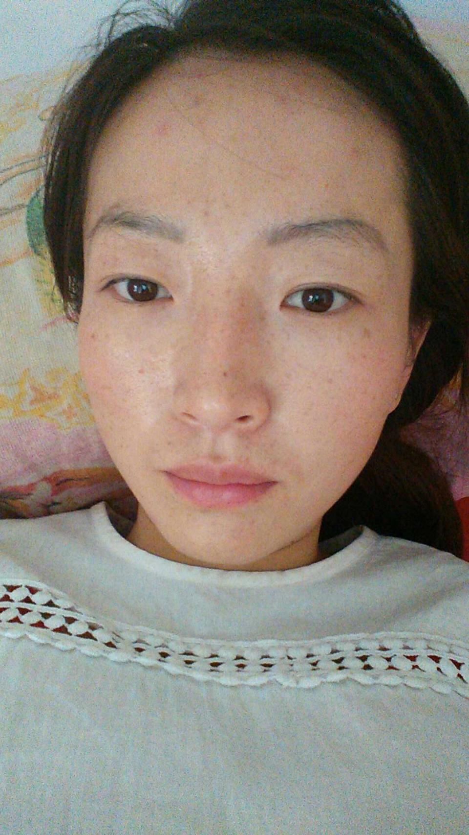 叔叔睡前给老婆偷偷抹点它,一夜脸上斑点一扫而空,脸蛋雪白透亮