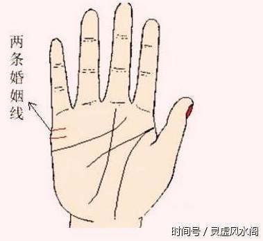 1.双重婚姻线,也就是指手掌中有两条平行的婚姻线.