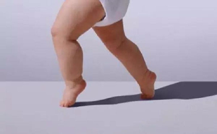孩子点着脚尖走路是正常的吗?