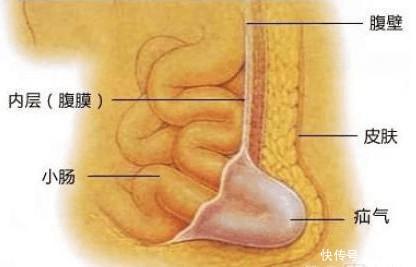 2岁宝宝"蛋蛋"被切除终身无法生育, 只因奶奶说了这么