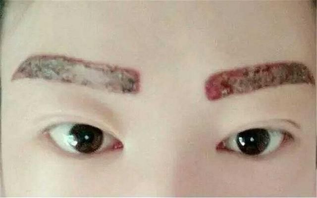 不纹眉的原因,看对比图知道了