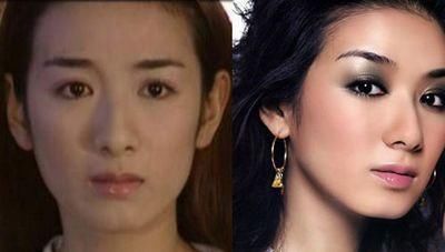面相中被称作"财库,金窝,美人沟,天使指痕"的下巴