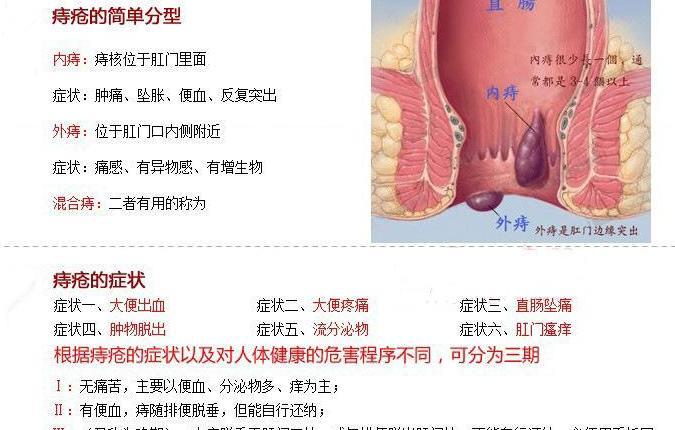 痔疮形成的生理原因, 对人体的影响.最佳治疗方法.