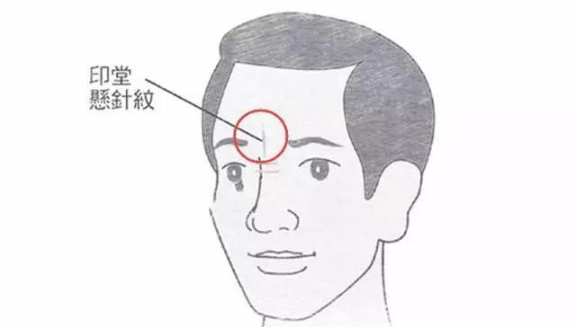 如果印堂正中有一条深深的竖纹的话,在面相中称为"悬针纹",民间通俗