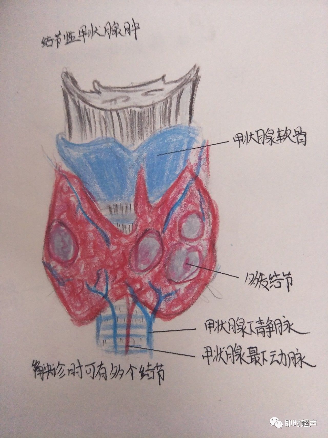 简单易懂的甲状腺超声手绘