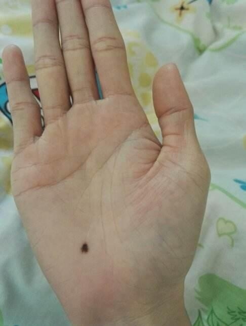 这些位置有痣的人,一生富贵,要人脉有人脉,要钱有钱!