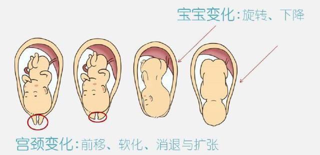 晓妍说|怎样理解分娩中的枕后位