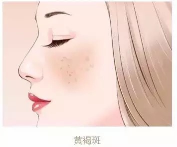 长斑的美眉都看过来了,这几个长斑时期要重视!