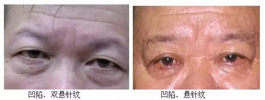 如何从面相看一个人的德行(阴德纹和缺德纹的看法)