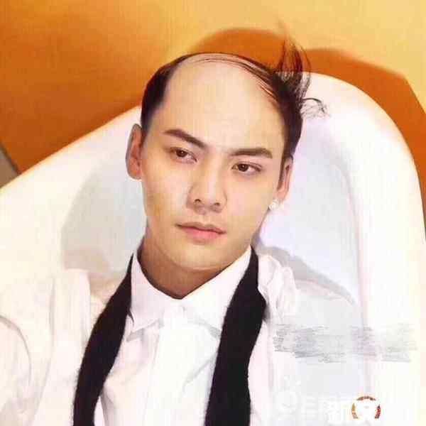 当明星们遇到地中海发型,感觉还是胡歌最帅啊!