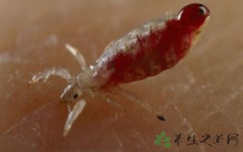 阴虱病有潜伏期吗