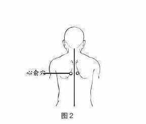 心俞穴:位于背部肩胛骨内侧,第5胸椎棘突下旁开1.