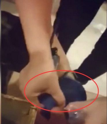 男子吃火锅感觉裤腿有点痒,掀开裤腿,男子差点吓晕过去