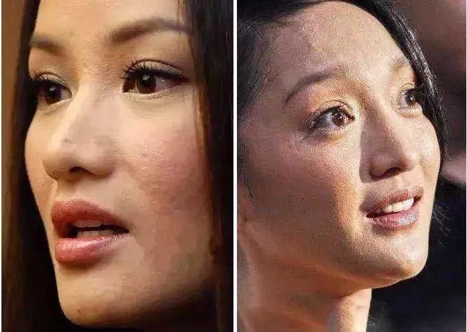 赵丽颖霍思燕黑头明显,林允真的没毛孔!
