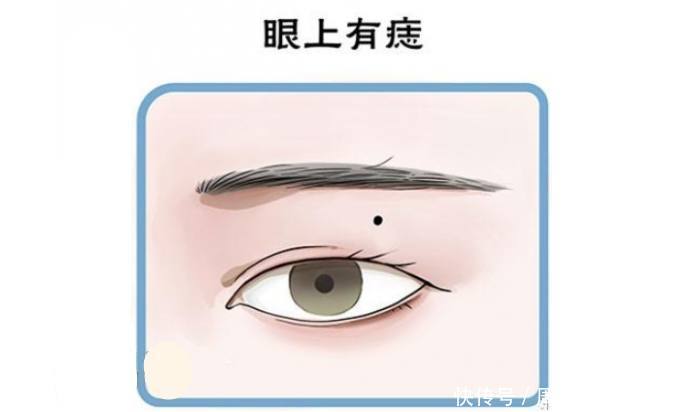 眼睛周围长痣看运势,眼睛这处长痣,中年转运,钱财无忧