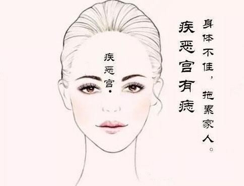 最影响女人幸福的五颗痣,最好想办法化解!