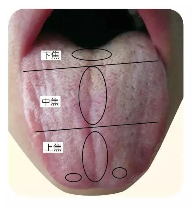 中医认为,舌尖代表心肺,舌中代表脾胃,舌根代表肾,舌两侧代表肝胆.
