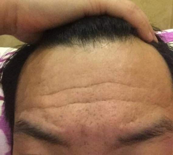 男人额头有皱纹,别傻傻不知道代表什么