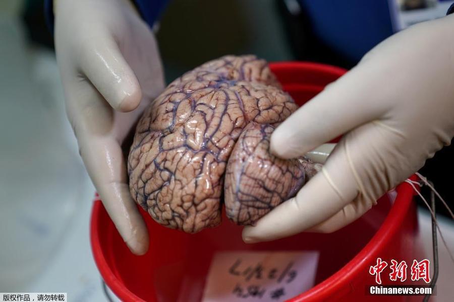 美国纽约大脑银行:冷冻保存人脑切片