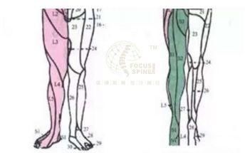 3,腹股沟及大腿前内侧痛 高位腰椎间盘突出时,突出的腰椎间盘可压迫2