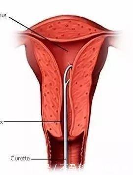 排卵期出血:两次月经间出血的一种