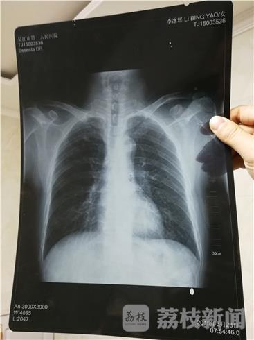 男人变女人"阴差阳错"的体检胸片-北京时间