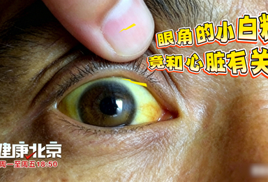 眼角的小白粒，竟和心脏有关？