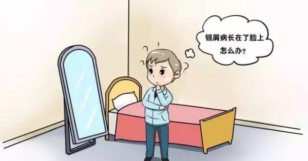 银屑病长在脸上影响颜值,肿么办? 银屑病长在脸上影响颜值,肿么办?