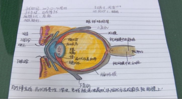 眼球的结构示意图手绘图片