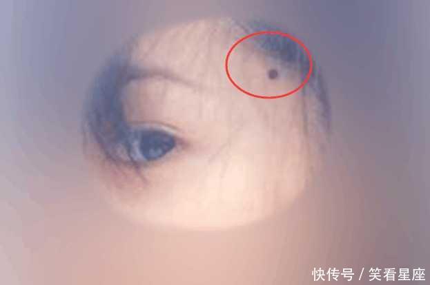 这六个地方长痣的女人最富贵,财运好,身体棒,能