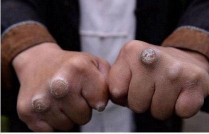 中国硬气功第一人,手劈鹅卵石称用内力战胜泰森,娶妻靠比武招亲